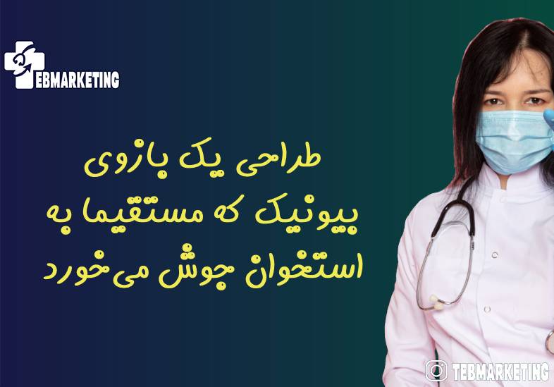 طراحی یک بازوی بیونیک که مستقیما به استخوان جوش میخورد