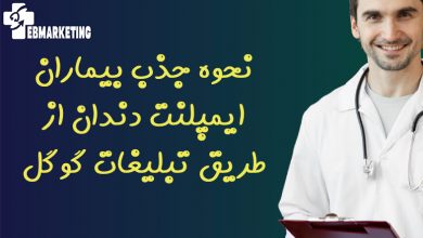 نحوه جذب بیماران ایمپلنت دندان از طریق تبلیغات گوگل