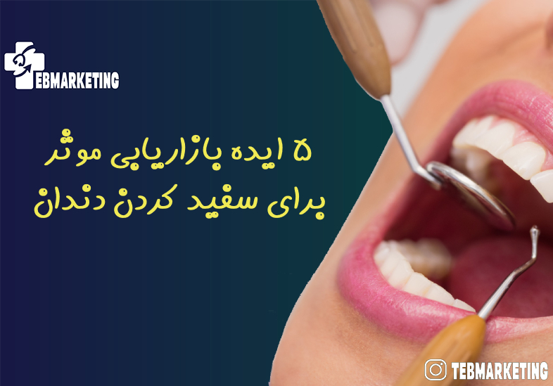 5 ایده بازاریابی موثر برای سفید کردن دندان