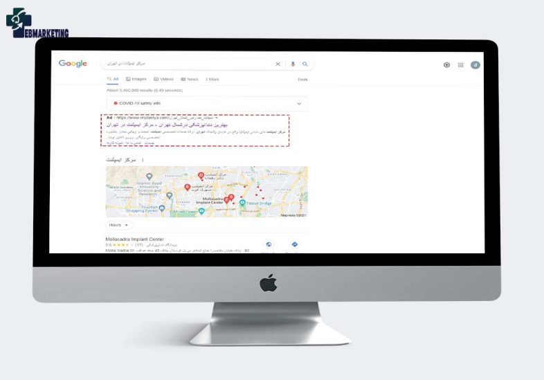 تبلیغات گوگل ادز برای کلینیک دندانپزشکی ایمپلنتیا