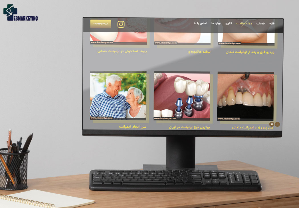 نمونه تولید محتوای سایت کلینیک دندانپزشکی ایمپلنتیا