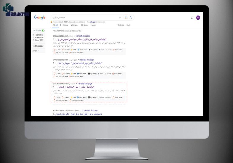 سئو سایت دکتر کاظم زاده با عبارت لابیاپلاستی با لیزر